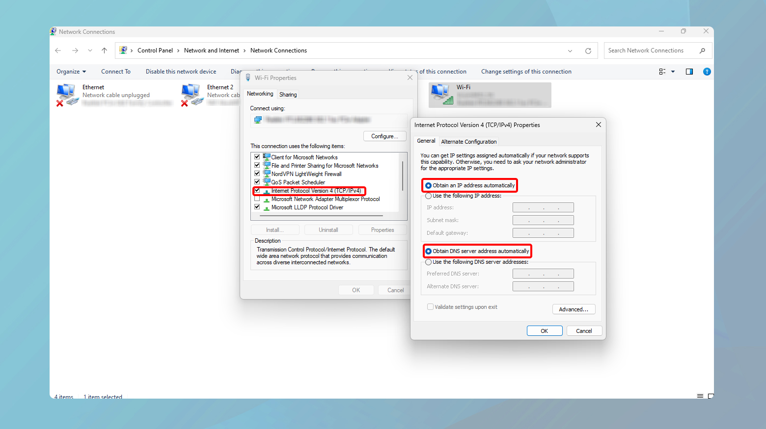Network settings in Windows with dns and IP highlighted.